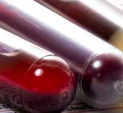 Revolution in der Krebsmedizin?: Schwachstellen des Tumors im Blut erkennen
