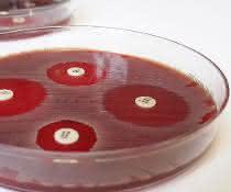 Der Plättchentest macht Antibiotika-Resistenzen sichtbar. Der Plättchentest macht Antibiotika-Resistenzen sichtbar.