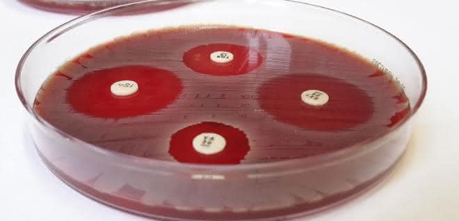 Der Plättchentest macht Antibiotika-Resistenzen sichtbar. Der Plättchentest macht Antibiotika-Resistenzen sichtbar.
