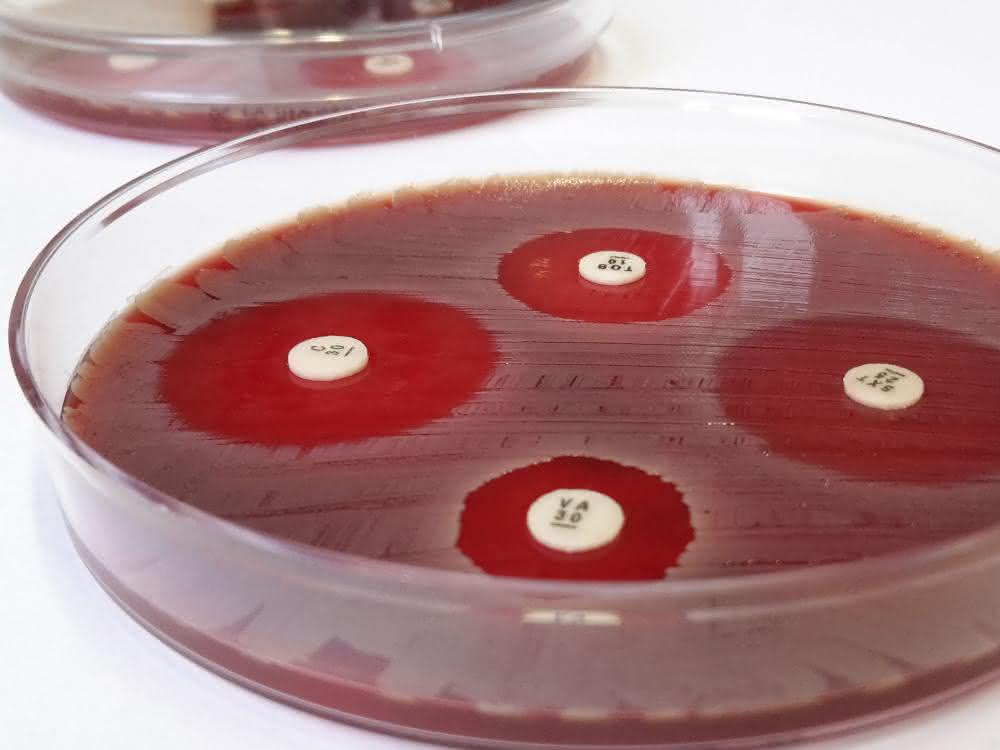 Der Plättchentest macht Antibiotika-Resistenzen sichtbar.