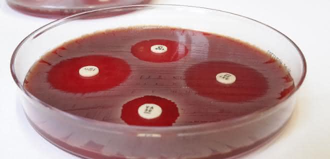 Der Plättchentest macht Antibiotika-Resistenzen sichtbar. Der Plättchentest macht Antibiotika-Resistenzen sichtbar.