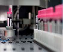 Moderne Biobanken tragen entscheidend dazu bei, innovative diagnostische Methoden und Therapien zu entwickeln. Moderne Biobanken tragen entscheidend dazu bei, innovative diagnostische Methoden und Therapien zu entwickeln.