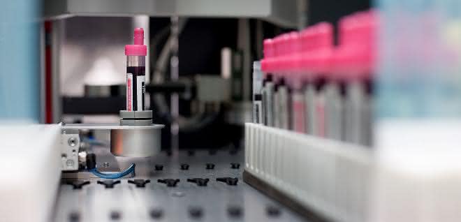 Moderne Biobanken tragen entscheidend dazu bei, innovative diagnostische Methoden und Therapien zu entwickeln. Moderne Biobanken tragen entscheidend dazu bei, innovative diagnostische Methoden und Therapien zu entwickeln.