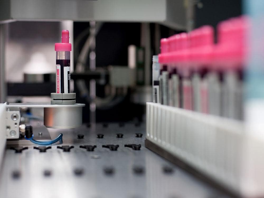 Moderne Biobanken tragen entscheidend dazu bei, innovative diagnostische Methoden und Therapien zu entwickeln.