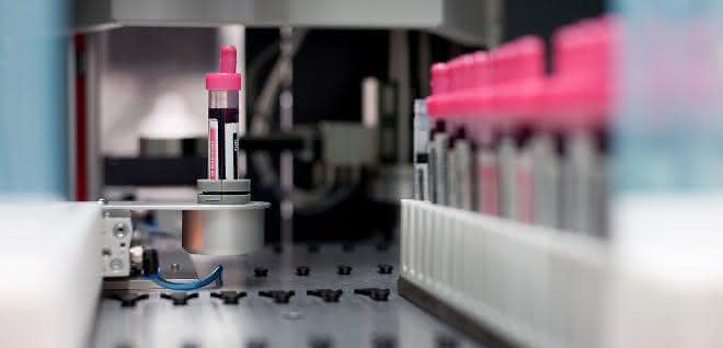Moderne Biobanken tragen entscheidend dazu bei, innovative diagnostische Methoden und Therapien zu entwickeln.