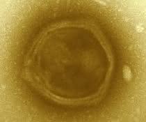 Elektronenmikroskopische Aufnahme eines Klosneuvirus-Partikels, der mit Hilfe genomischer Methoden durch ForscherInnen der Universität Wien in einer Kläranlage in Klosterneuburg entdeckt wurde.