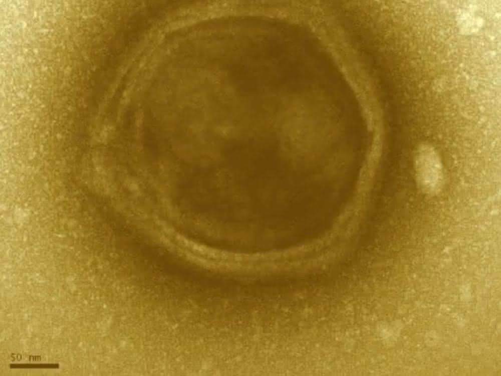 Elektronenmikroskopische Aufnahme eines Klosneuvirus-Partikels, der mit Hilfe genomischer Methoden durch ForscherInnen der Universität Wien in einer Kläranlage in Klosterneuburg entdeckt wurde.
