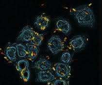 Epithelzellen in der Lunge (blau) werden von Pseudomonas aeruginosa angegriffen und besiedelt (gelb: Siedler; rot: Schwärmer). Epithelzellen in der Lunge (blau) werden von Pseudomonas aeruginosa angegriffen und besiedelt (gelb: Siedler; rot: Schwärmer).