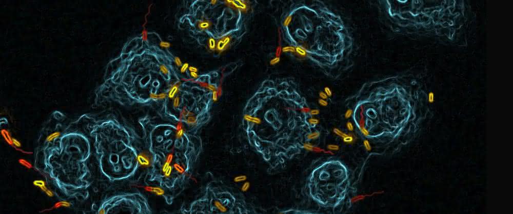 Epithelzellen in der Lunge (blau) werden von Pseudomonas aeruginosa angegriffen und besiedelt (gelb: Siedler; rot: Schwärmer). Epithelzellen in der Lunge (blau) werden von Pseudomonas aeruginosa angegriffen und besiedelt (gelb: Siedler; rot: Schwärmer).
