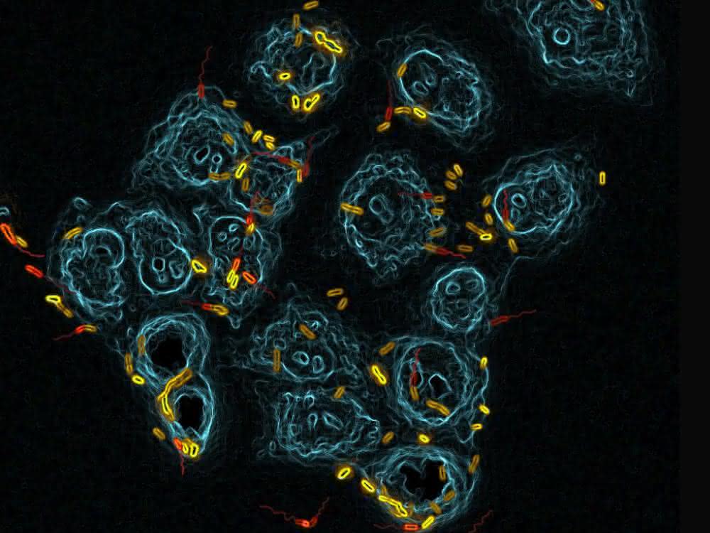 Epithelzellen in der Lunge (blau) werden von Pseudomonas aeruginosa angegriffen und besiedelt (gelb: Siedler; rot: Schwärmer).