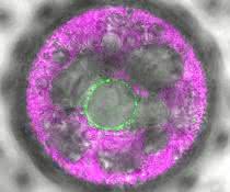 In dieser mehrzelligen Volvox-Alge wurde der neuartige Lichtsensor 2c-Cyclop mit Fluoreszenz markiert. Er zeigt sich (grün) in Membranen um den Zellkern herum. In dieser mehrzelligen Volvox-Alge wurde der neuartige Lichtsensor 2c-Cyclop mit Fluoreszenz markiert. Er zeigt sich (grün) in Membranen um den Zellkern herum.