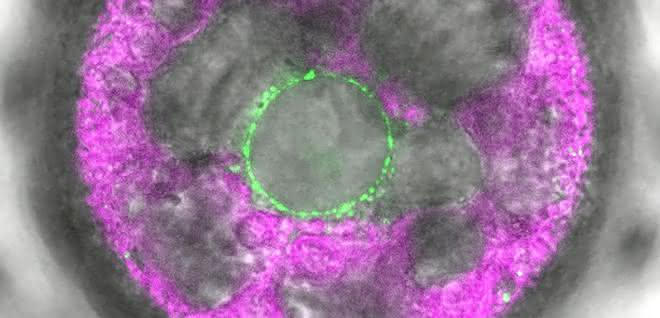 In dieser mehrzelligen Volvox-Alge wurde der neuartige Lichtsensor 2c-Cyclop mit Fluoreszenz markiert. Er zeigt sich (grün) in Membranen um den Zellkern herum. In dieser mehrzelligen Volvox-Alge wurde der neuartige Lichtsensor 2c-Cyclop mit Fluoreszenz markiert. Er zeigt sich (grün) in Membranen um den Zellkern herum.
