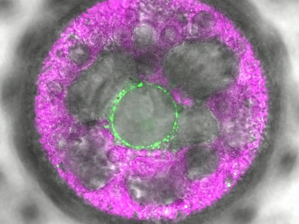 In dieser mehrzelligen Volvox-Alge wurde der neuartige Lichtsensor 2c-Cyclop mit Fluoreszenz markiert. Er zeigt sich (grün) in Membranen um den Zellkern herum.