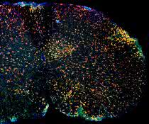 Immunfluoreszenz von entzündlich verändertem Rückenmark mit roten Mikrogliazellen und grünen aus dem Blut eingewanderten Makrophagen. Immunfluoreszenz von entzündlich verändertem Rückenmark mit roten Mikrogliazellen und grünen aus dem Blut eingewanderten Makrophagen.