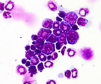 Bone marrow cells of the mouse (cytospin, May-Grünwald / Giemsa staining)