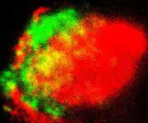 Die Proteine C1q (grün) und ApoE (rot) lagern sich im Plexus choroideus ab, wie die Forscher mittels höchstauflösender Mikroskopie zeigen. (Balken: 1 µm) Die Proteine C1q (grün) und ApoE (rot) lagern sich im Plexus choroideus ab, wie die Forscher mittels höchstauflösender Mikroskopie zeigen.