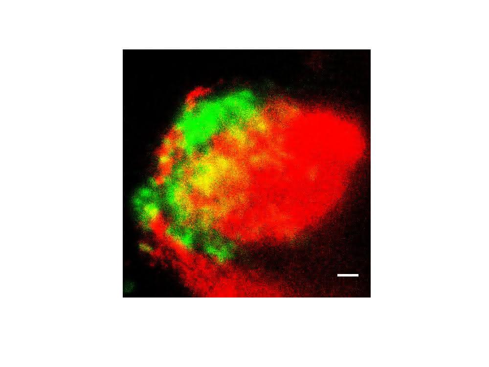 Die Proteine C1q (grün) und ApoE (rot) lagern sich im Plexus choroideus ab, wie die Forscher mittels höchstauflösender Mikroskopie zeigen.