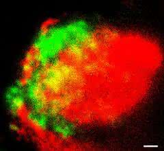 Die Proteine C1q (grün) und ApoE (rot) lagern sich im Plexus choroideus ab, wie die Forscher mittels höchstauflösender Mikroskopie zeigen. (Balken: 1 µm) Die Proteine C1q (grün) und ApoE (rot) lagern sich im Plexus choroideus ab, wie die Forscher mittels höchstauflösender Mikroskopie zeigen.
