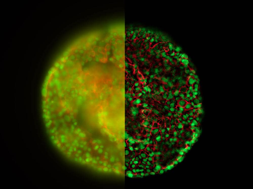 HeLa-Zell-Sphäroid gefärbt mit Alexa Fluor 568 Phalloidin (Actin) und YOYO 1 Jodid (Nucleus). Bild der gleichen Probe, aufgenommen mit einem Standard-Weitfeld-Fluoreszenzmikroskop (links) und einem Thunder-Imager (rechts). Mikroskopische Aufnahmen