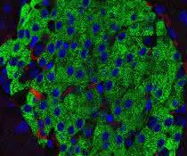 Fluoreszenzmikroskopische Aufnahme einer Langerhans-Insel