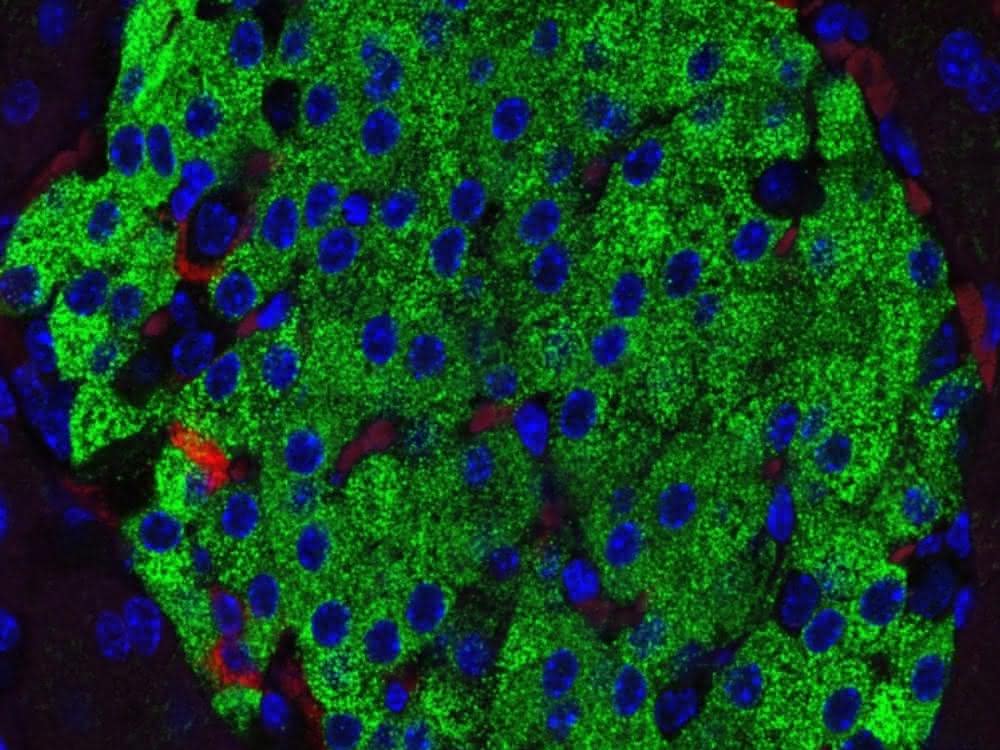 Fluoreszenzmikroskopische Aufnahme einer Langerhans-Insel Fluoreszenzmikroskopische Aufnahme einer Langerhans-Insel