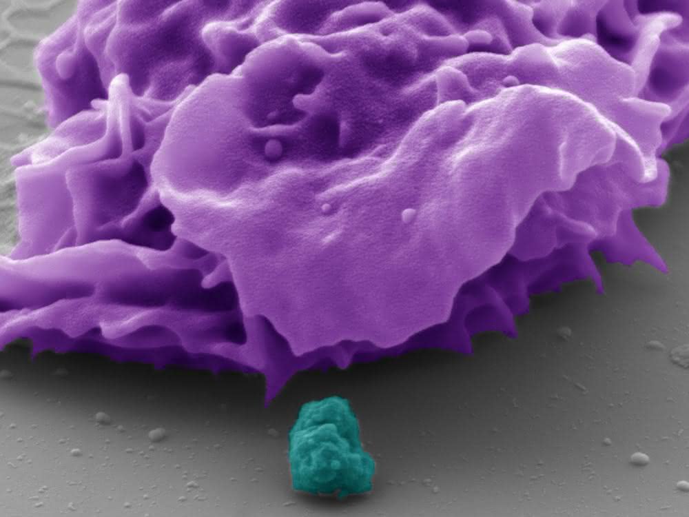 Die pseudokolorierte elektronenmikroskopische Aufnahme zeigt eine menschliche Fresszelle (lila dargestellt) und ein Bakterium (türkis dargestellt). Mit Hilfe des Rezeptors CEACAM3 ist die Fresszelle in der Lage, die etwa einen Mikrometer großen Bakterien zu erkennen und zu vernichten.