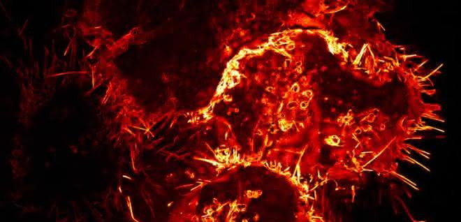 Mikroskopische Aufnahme: Menschliche Zellen, die Virosomen produzieren