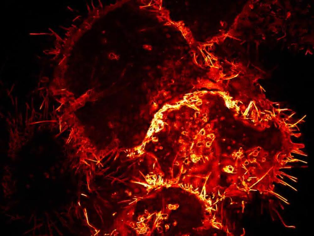 Mikroskopische Aufnahme: Menschliche Zellen, die Virosomen produzieren