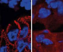 In gesunden Mäusen wird das rot markierte Protein (Desmoplakin) von den Darmzellen in Desmosomen eingebaut (links). Ein fehlerhafter Insulinsignalweg führt zum Verbleib des Proteins im Zellplasma (rechts). In gesunden Mäusen wird das Protein Desmoplakin von den Darmzellen in Desmosomen eingebaut. Ein fehlerhafter Insulinsignalweg führt zum Verbleib des Proteins im Zellplasma.