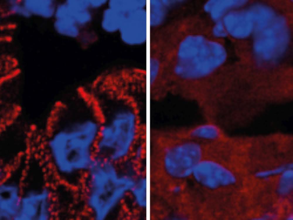 In gesunden Mäusen wird das Protein Desmoplakin von den Darmzellen in Desmosomen eingebaut. Ein fehlerhafter Insulinsignalweg führt zum Verbleib des Proteins im Zellplasma.