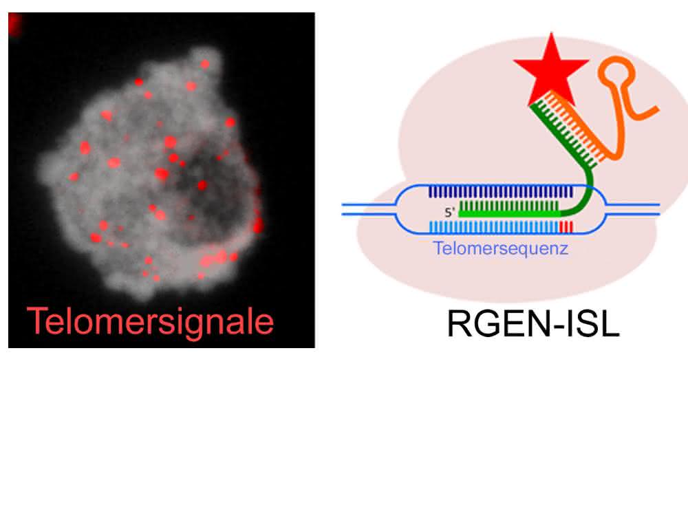 Zellkern der Fleckbohne mit Telomer-spezifischen Signalen (in rot), welche mit Hilfe der CRISPR/Cas9-basierten REGN-ISL Methode detektiert wurden.