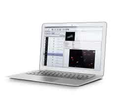 Screenshot des ParticleScout