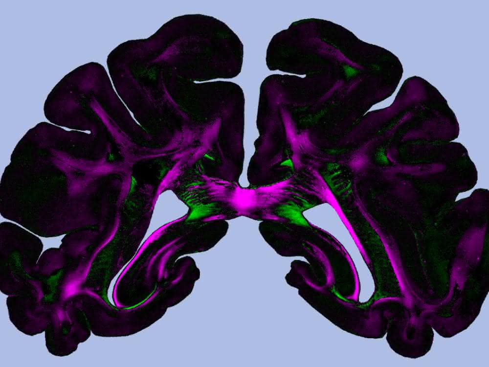 „Diattenuation Imaging“ (DI) kann zur genauen Untersuchung von Hirngewebe  eingesetzt werden.