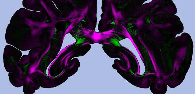 „Diattenuation Imaging“ (DI) kann zur genauen Untersuchung von Hirngewebe eingesetzt werden. „Diattenuation Imaging“ (DI) kann zur genauen Untersuchung von Hirngewebe eingesetzt werden.