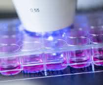Humane Hepatoma-Zellen, die mit Hepatitis-E-Viren infiziert wurden, werden mittels Immunfluoreszenz analysiert.