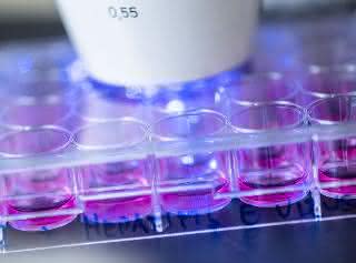 Humane Hepatoma-Zellen, die mit Hepatitis-E-Viren infiziert wurden, werden mittels Immunfluoreszenz analysiert.