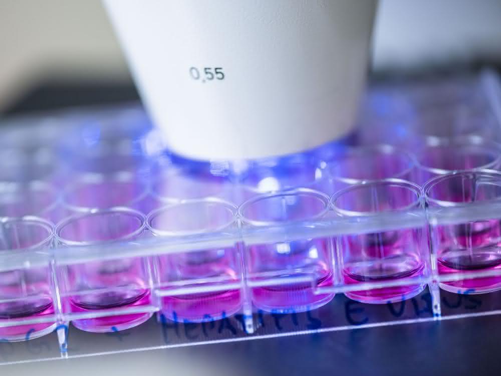 Humane Hepatoma-Zellen, die mit Hepatitis-E-Viren infiziert wurden, werden mittels Immunfluoreszenz analysiert.