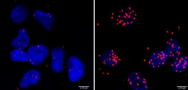 Zellen eines Neuroblastoms