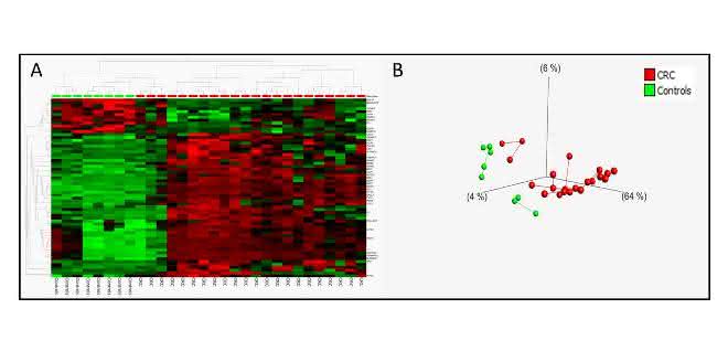 Bild 3: A: Heatmap zur Darstellung unterschiedlich methylierter CpGs basierend auf Infinium-Array-Methylierungsanalysen von Tumor-DNA ...
