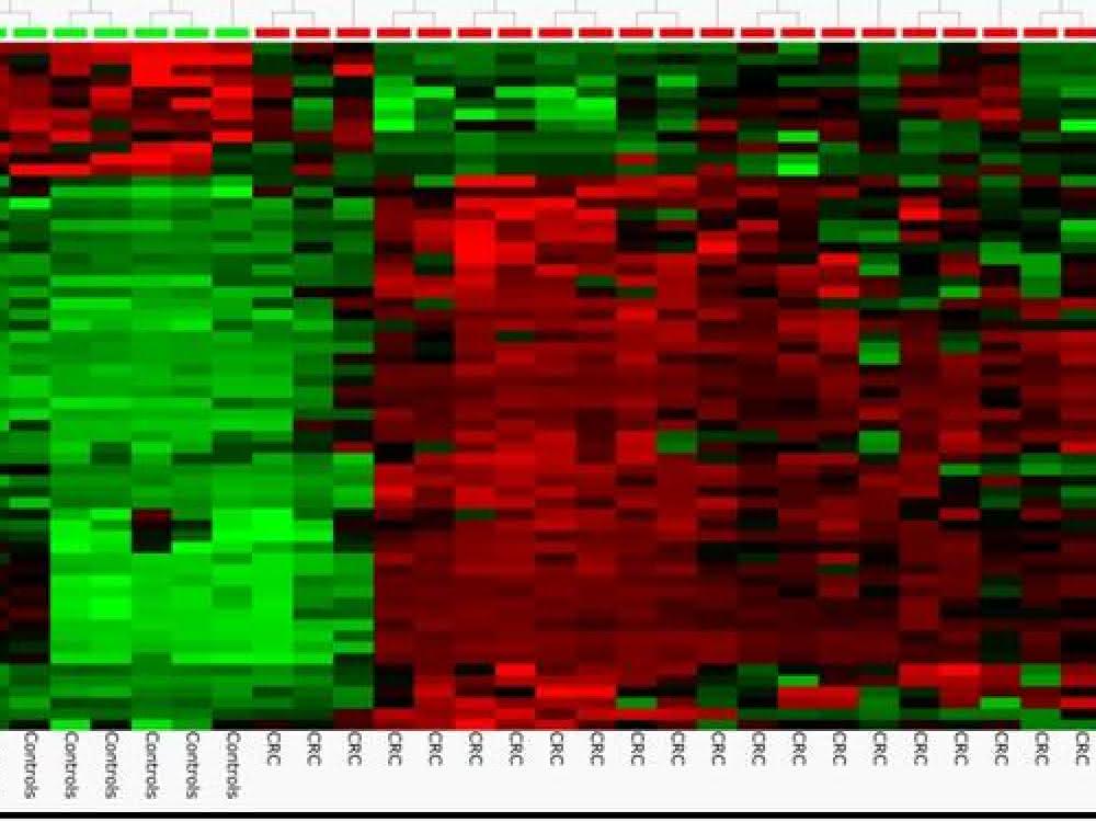 Liquid Biopsy: DNA-Methylierungsanalyse  auf dem Vormarsch