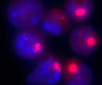Zellkerne von weiblichen Zellen. Die Xist-Moleküle, die für die Inaktivierung des zweiten X-Chromosoms verantwortlich sind, sind mit einem roten Farbstoff markiert.