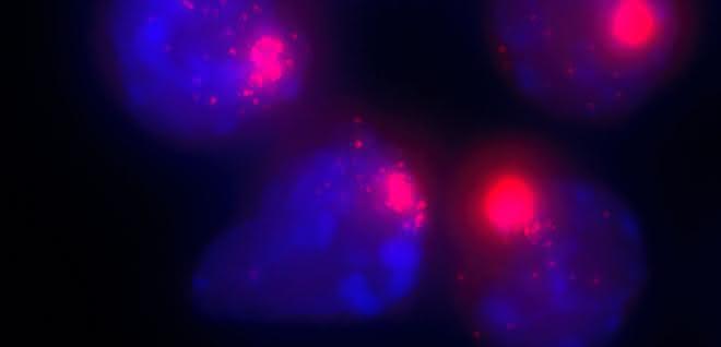 Zellkerne von weiblichen Zellen. Die Xist-Moleküle, die für die Inaktivierung des zweiten X-Chromosoms verantwortlich sind, sind mit einem roten Farbstoff markiert. Zellkerne von weiblichen Zellen. Die Xist-Moleküle, die für die Inaktivierung des zweiten X-Chromosoms verantwortlich sind, sind mit einem roten Farbstoff markiert.