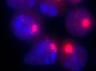 Zellkerne von weiblichen Zellen. Die Xist-Moleküle, die für die Inaktivierung des zweiten X-Chromosoms verantwortlich sind, sind mit einem roten Farbstoff markiert.