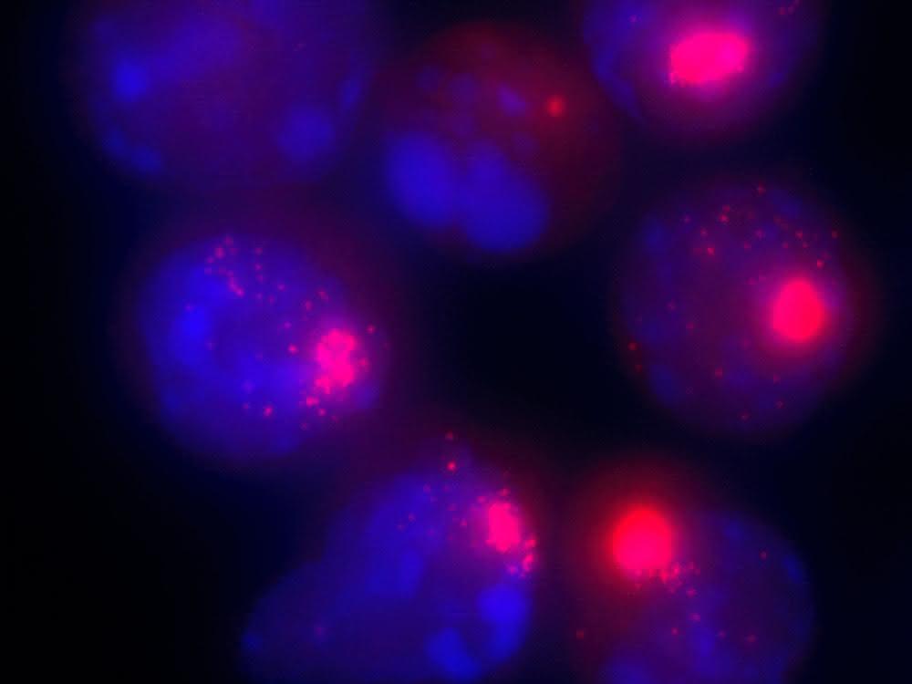 Zellkerne von weiblichen Zellen. Die Xist-Moleküle, die für die Inaktivierung des zweiten X-Chromosoms verantwortlich sind, sind mit einem roten Farbstoff markiert.