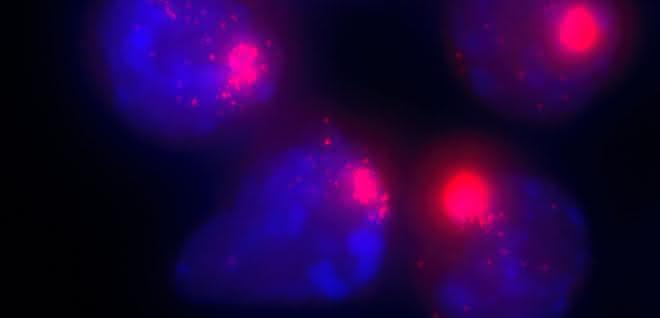 Zellkerne von weiblichen Zellen. Die Xist-Moleküle, die für die Inaktivierung des zweiten X-Chromosoms verantwortlich sind, sind mit einem roten Farbstoff markiert.