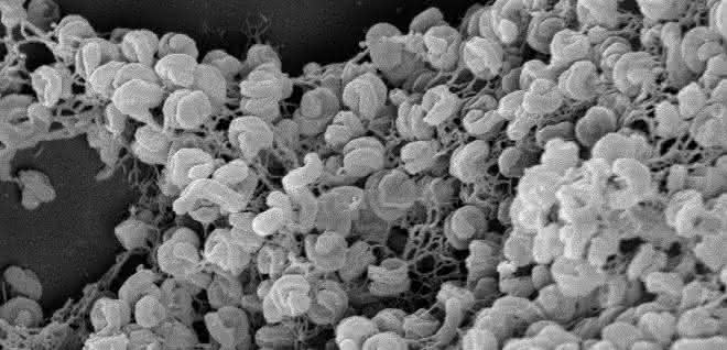 Elektronenmikroskopische Aufnahme eines Zell-Aggregats von Comammox-Bakterien der Art Nitrospira inopinata.