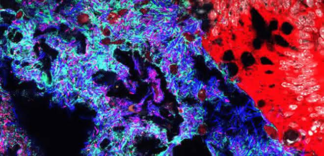 Mucispirillum (grün) und Salmonella (pink) im Darmlumen von Mäusen. Andere Bakterien sind in blau, das Darmepithel in rot dargestellt. Mucispirillum (grün) und Salmonella (pink) im Darmlumen von Mäusen. Andere Bakterien sind in blau, das Darmepithel in rot dargestellt.