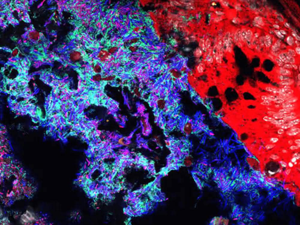 Mucispirillum (grün) und Salmonella (pink) im Darmlumen von Mäusen. Andere Bakterien sind in blau, das Darmepithel in rot dargestellt.