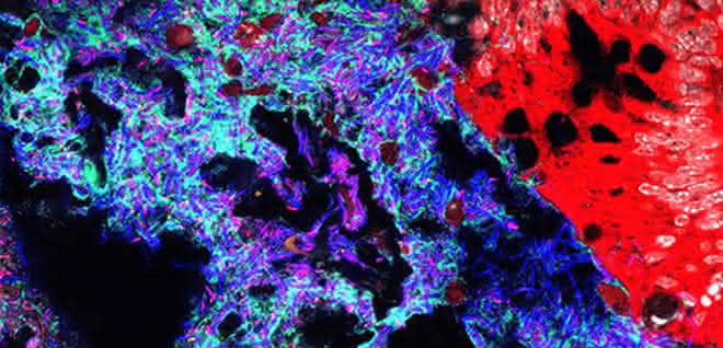 Mucispirillum (grün) und Salmonella (pink) im Darmlumen von Mäusen. Andere Bakterien sind in blau, das Darmepithel in rot dargestellt.