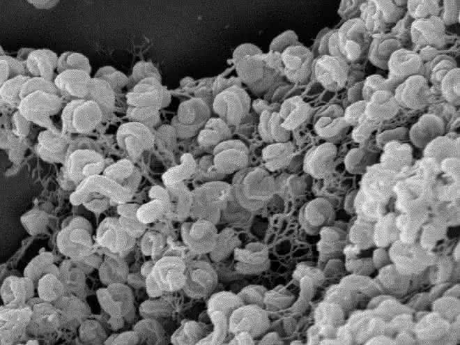 Elektronenmikroskopische Aufnahme eines Zell-Aggregats von Comammox-Bakterien der Art Nitrospira inopinata. Elektronenmikroskopische Aufnahme eines Zell-Aggregats von Comammox-Bakterien der Art Nitrospira inopinata.